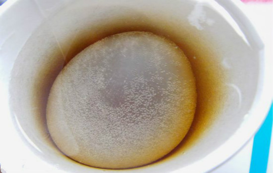 白醋鸡蛋祛斑有用吗白醋鸡蛋祛斑靠谱还是坑爹