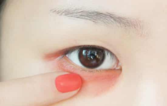 口红怎么遮黑眼圈,口红遮黑眼圈,橘色口红遮黑眼圈