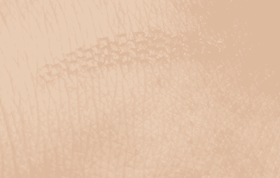 隐形双眼皮贴教程,隐形双眼皮贴贴法解图,隐形