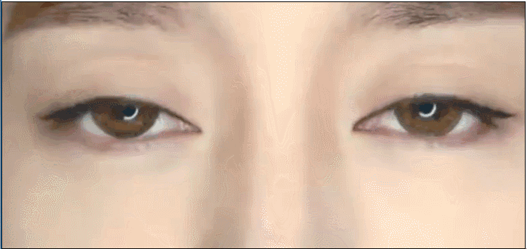 开眼角图解 b84948dfaf1bca85615e93caf5b02f97_450_0.gif