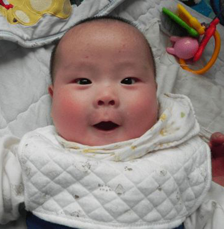 婴儿湿疹反复的原因 可能是这十点！