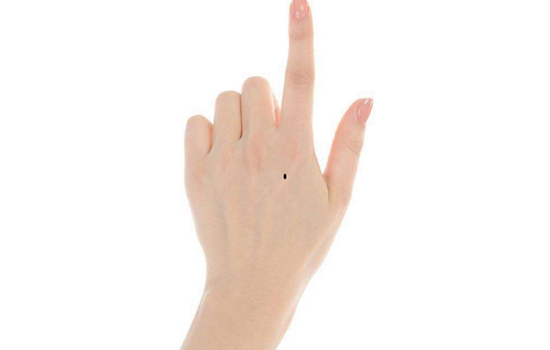 双生痣长在什么位置最好 5a40d5c26db42_550_0.png