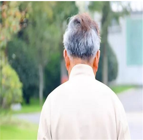 过早白发是怎么回事 过早白发的原因竟是这个