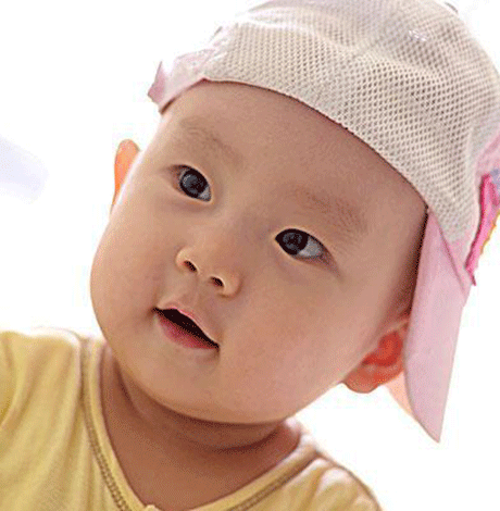 如何避免宝宝长胎记 孕妈妈要谨记这三点