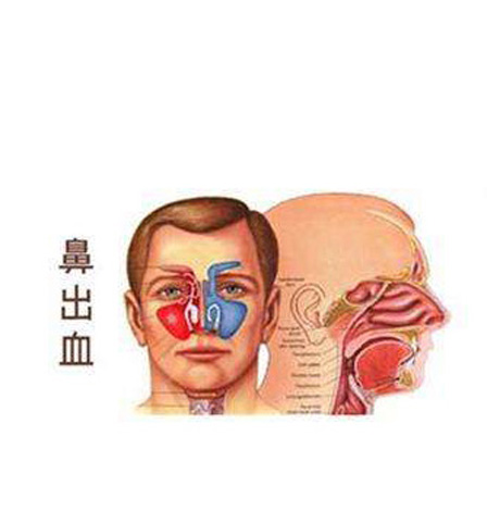 鼻出血后吐痰有血 鼻腔和咽喉其实是相通的