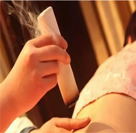 艾灸的功效及禁忌 艾灸到底有什么好处