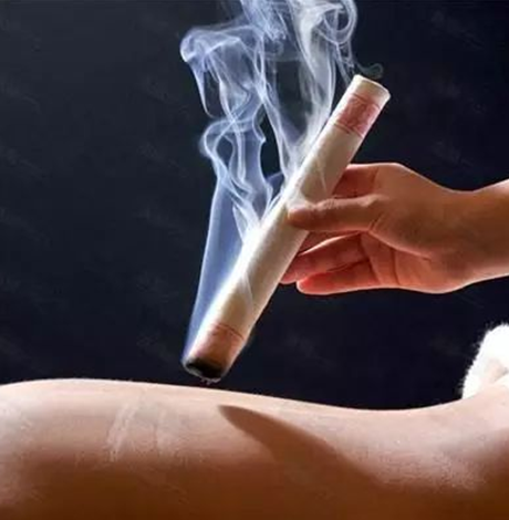 经常艾灸对女人的好处 真的超出你的想象