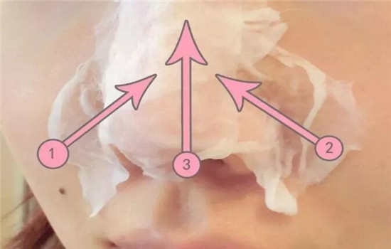 健康水湿敷多久 5ef1b5b6aa2dd_550_0.jpg