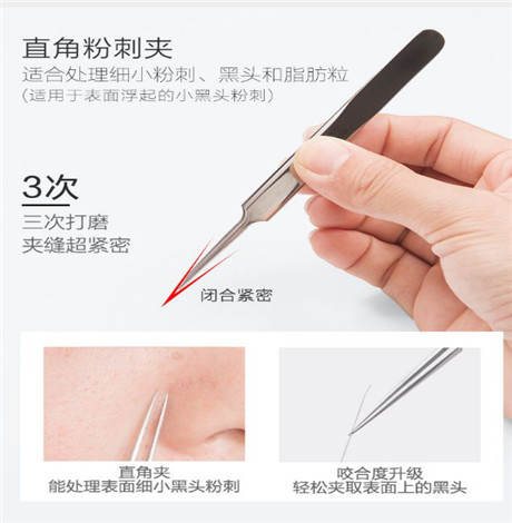 细胞夹去黑头好用吗 细胞夹如何正确使用