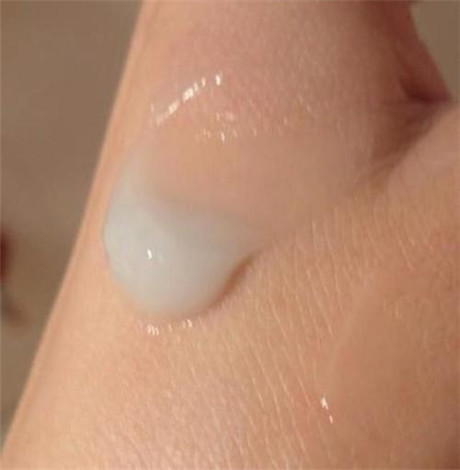 尿囊素与尿素的区别