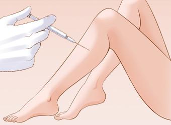小腿打瘦腿针有副作用吗(小腿抽脂好还是打瘦腿针好)