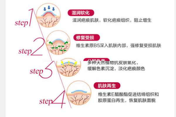 ISDIN怡思丁是哪个国家的 祛疤效果怎么样
