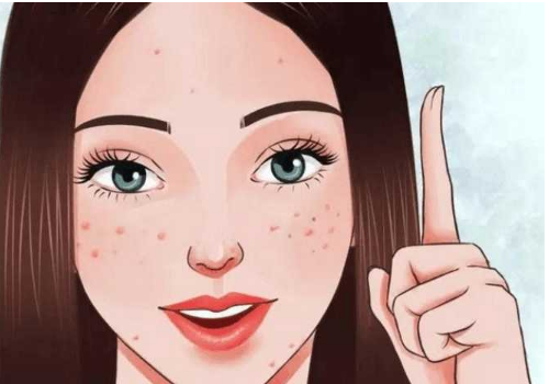 激素脸造成的原因是什么 怎么护理