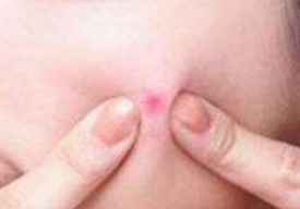 vt痘痘贴好用吗怎么样 vt痘痘贴防水吗