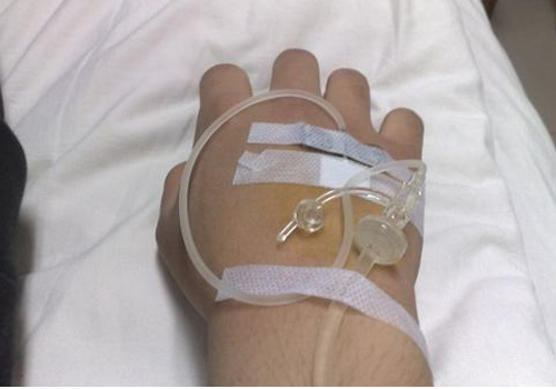 输液拔针后按压多久输完后头晕恶心四肢无力是怎么回事