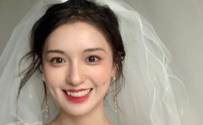 原来头发很厚越来越少还能长回去吗