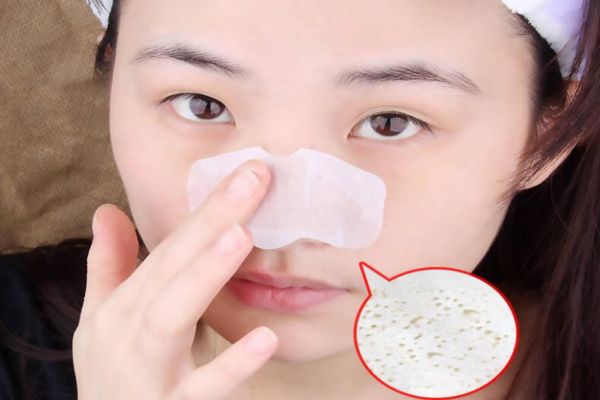怎样正确的去黑头 黑头怎么去除最有效