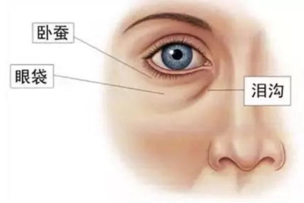 眼袋能热敷吗 眼袋是热敷还是冷敷