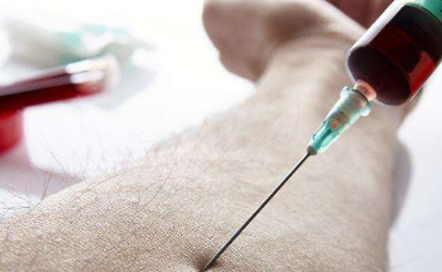 艾滋病属于几级危险等级 艾滋病一年要花多少钱2022